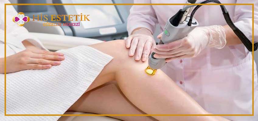 lazer epilasyon kaç günde bir yapılmalı