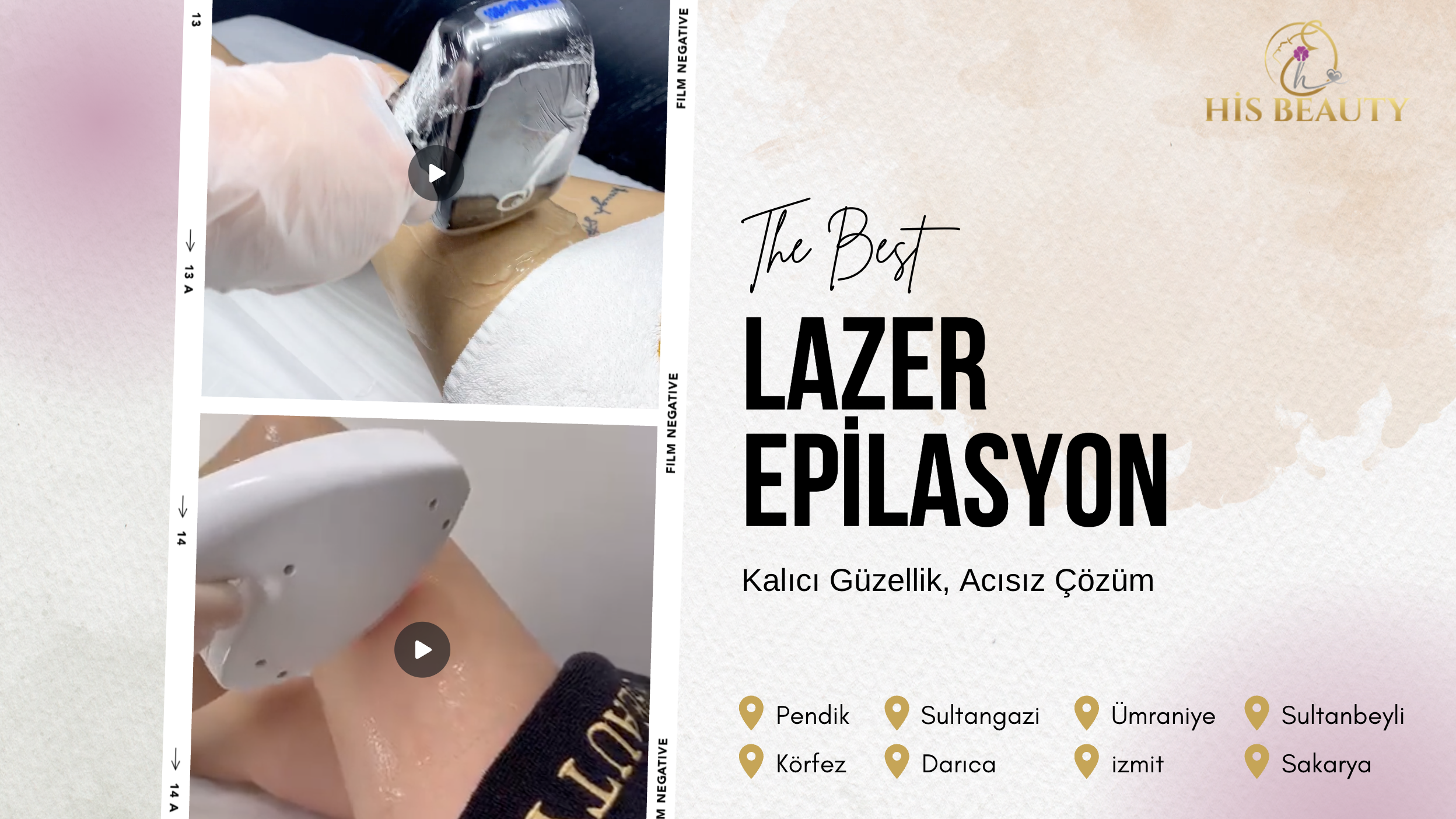 Lazer Epilasyon